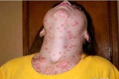 艾滋病毒在水产上存活,河里游泳会感染艾滋病吗