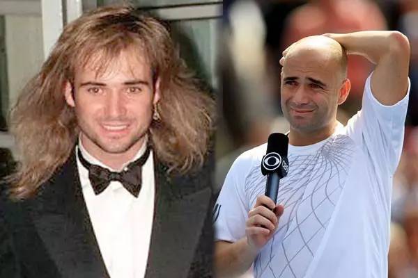 健身太猛会掉头发吗,为什么健身的男人秃头