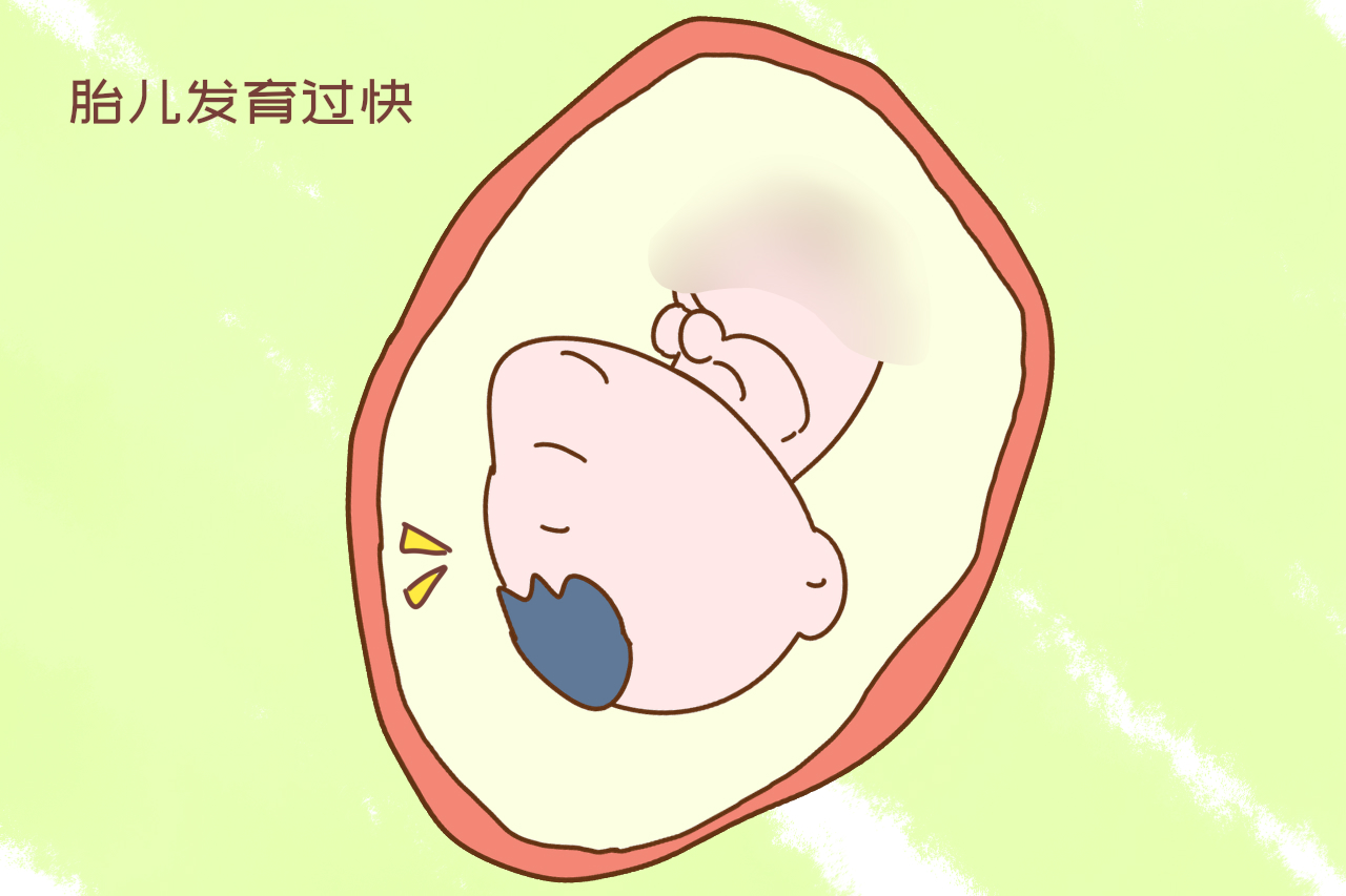 产检时医生说头大脚长腹围宽,孕妇产检医生说孩子头比较大