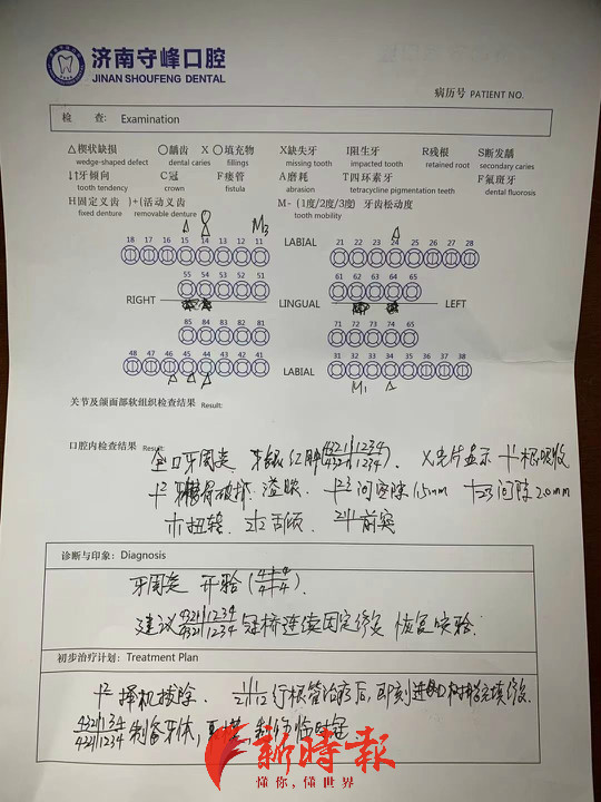 济南牙齿残根修复,济南一男子修牙后变鲨鱼齿