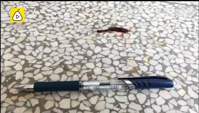 男童反复流鼻血竟是一条大蚂蝗,5岁男孩取出蚂蟥