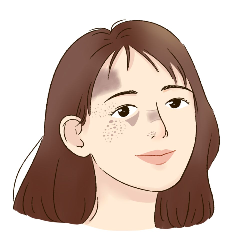 脸上有斑用什么护肤品祛斑效果好,40岁女人脸上长斑怎样有效祛斑