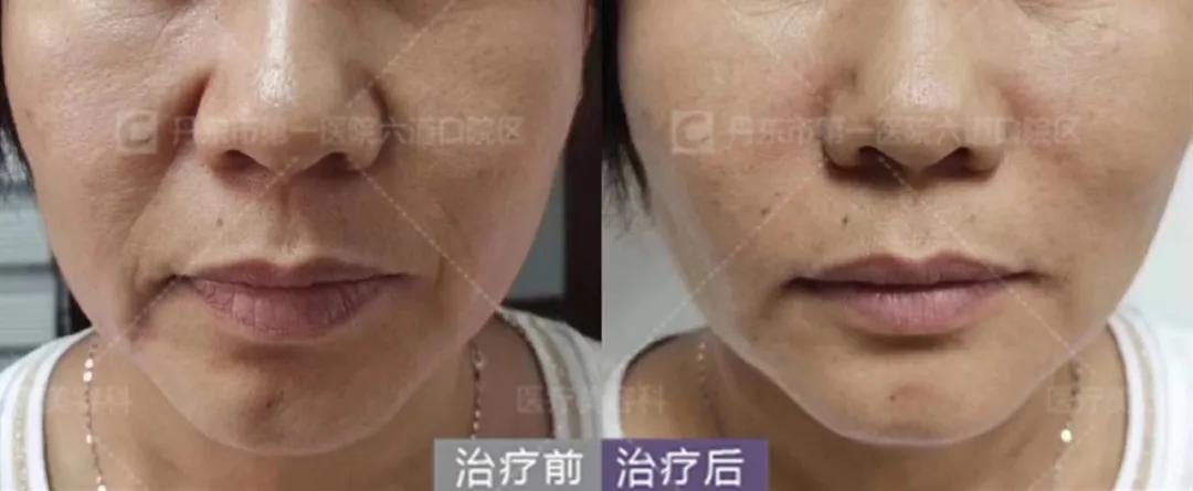 拥有一张好看的脸,如何拥有好看的脸型