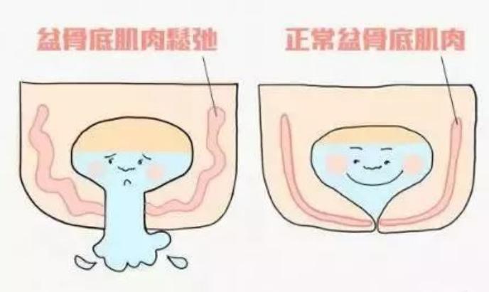 产妇生完孩子遭嫌弃,产妇生完孩子尿频尿不尽