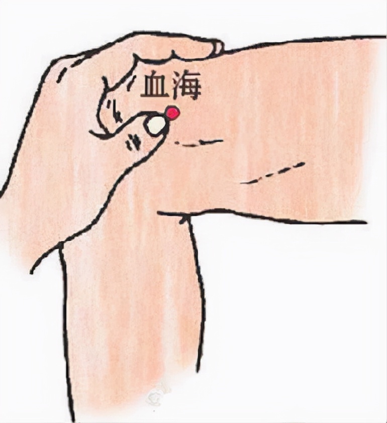 儿童湿疹瘙痒结痂,肛周湿疹结痂瘙痒中医