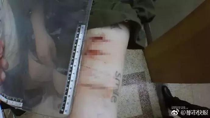 八岁小孩吸了一口氢气有事吗,青少年吸食笑气的危害有几类