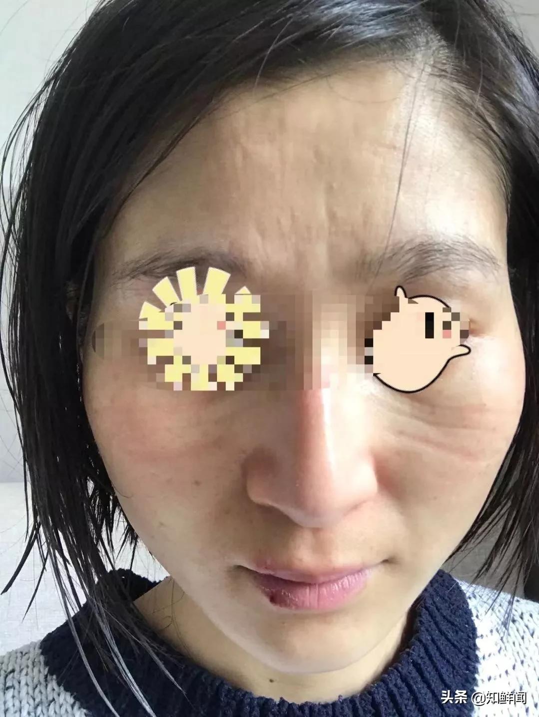 淮安市第一人民医院呼吸科王继鹏,淮安市第一人民医院呼吸科夏继国