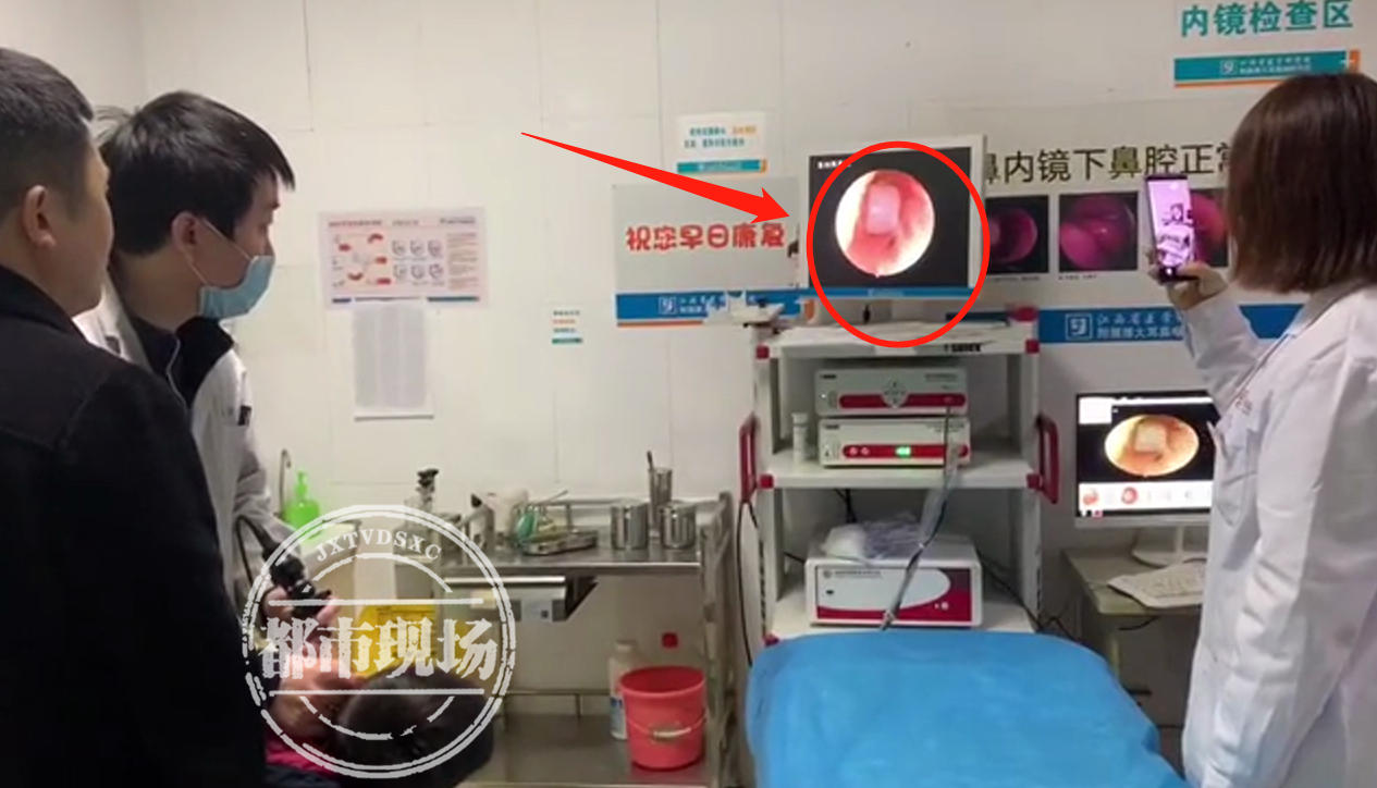 儿童耳朵进异物做手术,儿童耳内塞异物后果