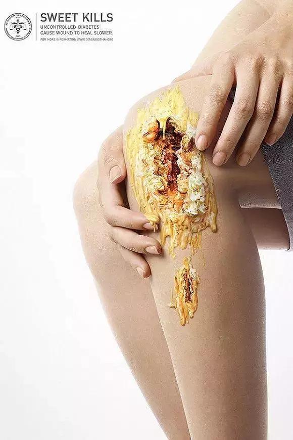 吃太多的糖会让你变胖,让你变丑变老的不是脂肪而是糖