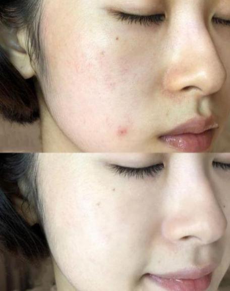 抗衰老皮肤干燥的面霜,对抗干纹的面霜