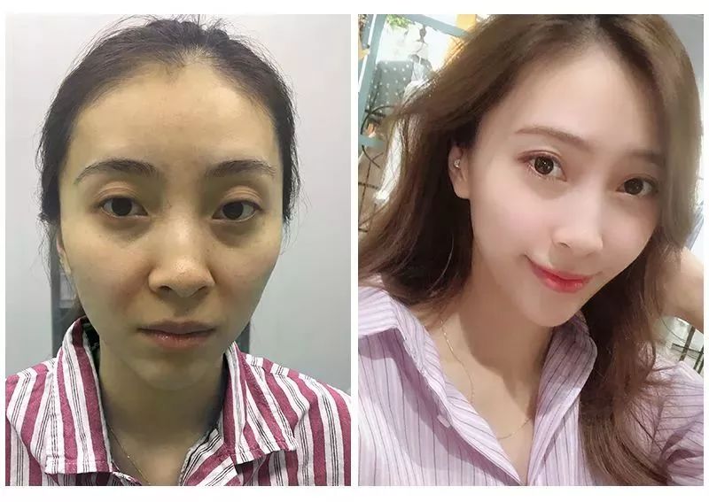 美白祛黄提亮肤色泡水喝,每天喝一杯可以美白淡斑清热解毒