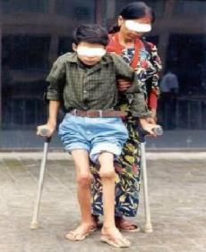 【掌健识】儿童血友病知识（2）：血友病的按需治疗