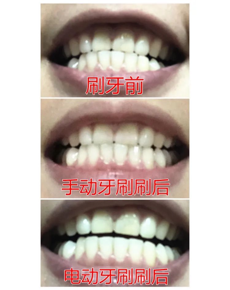 网红竹炭牙膏真的有用吗 (抖音竹炭洗白牙膏是真的吗)