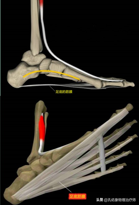 足底筋膜炎痛怎么治疗,足跟痛足底筋膜炎怎么治疗