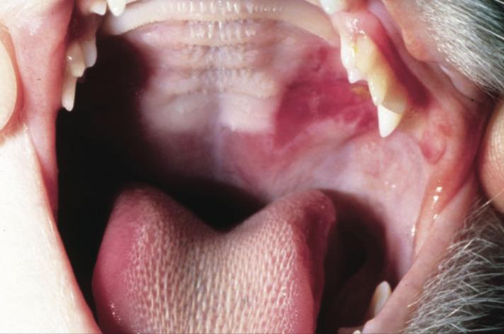 猫咪舌头有溃疡，怎么办？