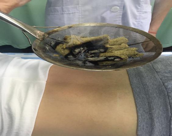 产后康复是怎么做的,产后康复从什么时候开始最好