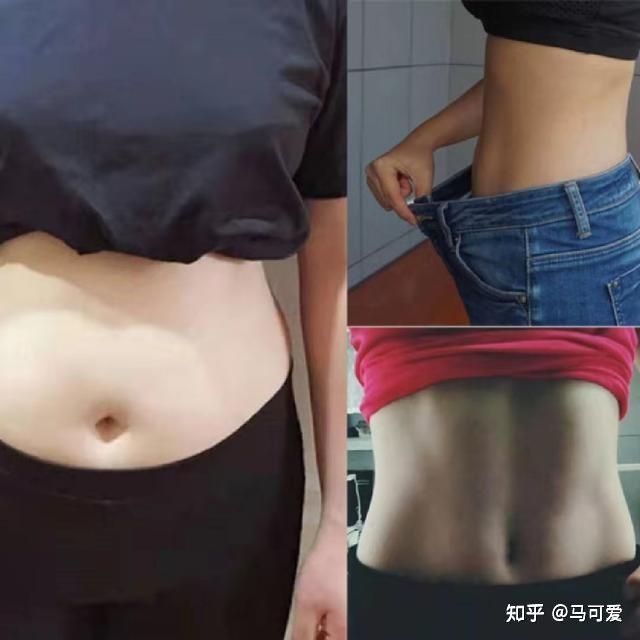 水肿腿加大象腿怎么瘦,大象腿赘肉多