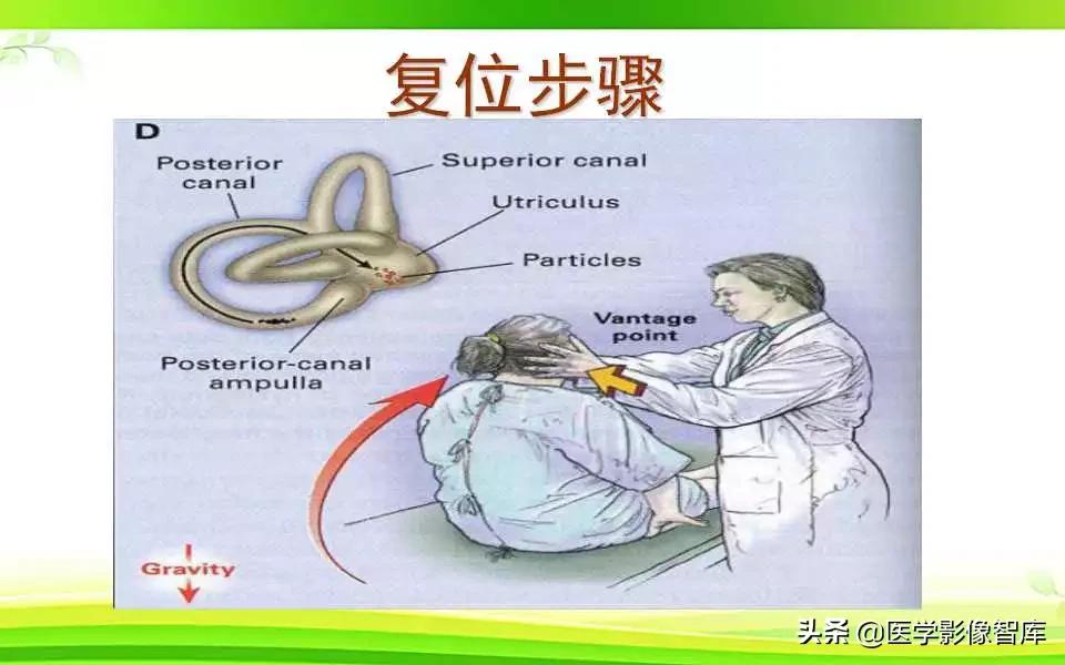 容易被误诊为耳石症的疾病,耳石症眩晕怎么确诊