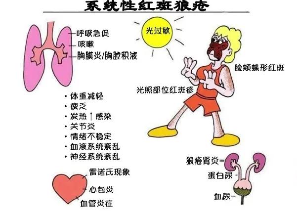 冬天冷的手变白怎么回事,冬天冷手指发白怎么回事