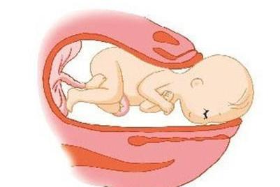 真假临产信号,如何辨别临产信号