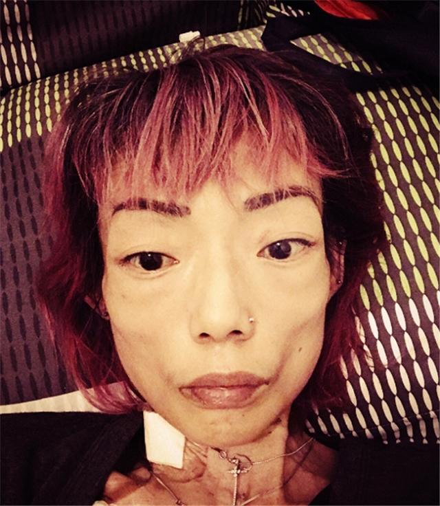 她为嫁豪门放弃牛津，吃*肥药减**致瘫痪体重仅剩44斤，遭夫弃终放下