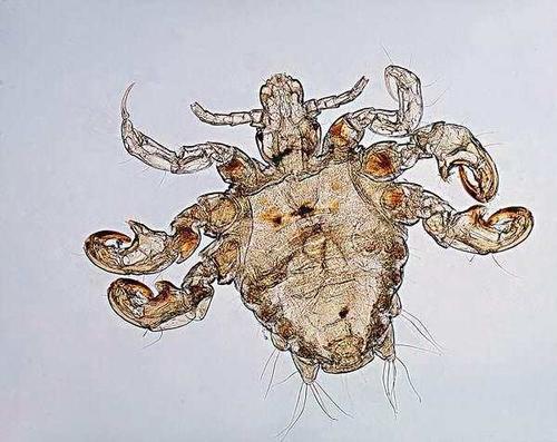 虱子存在的环境是哪样的,为啥阴虱比普通虱子难以去除