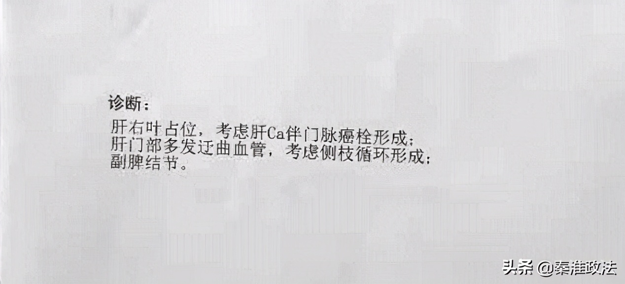 33岁小伙得肝癌,33岁肝癌晚期