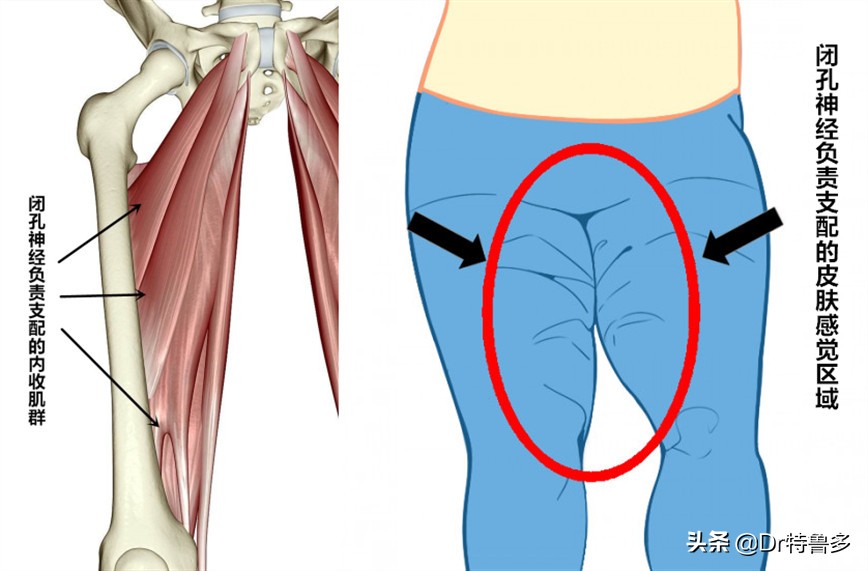 大腿内侧疼是压迫哪根神经引起的,大腿内侧神经疼要警惕