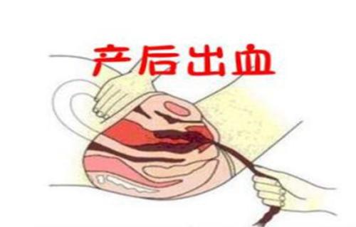 产后出血护理措施不包括,羊产后出血治疗土办法