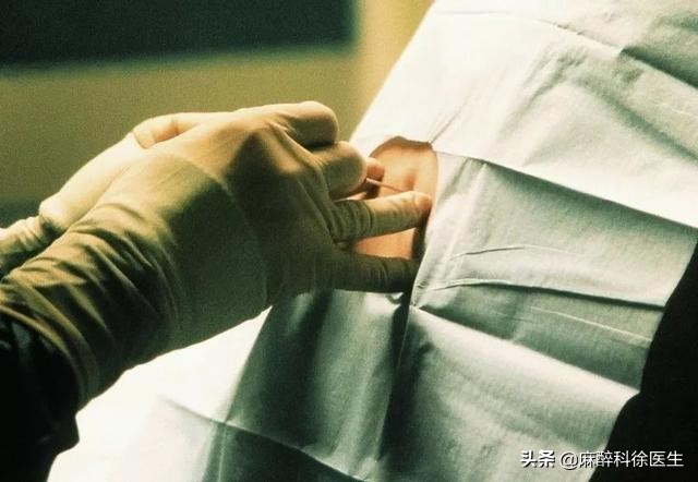 局部麻醉是什么体验,麻醉就是麻醉什么感觉