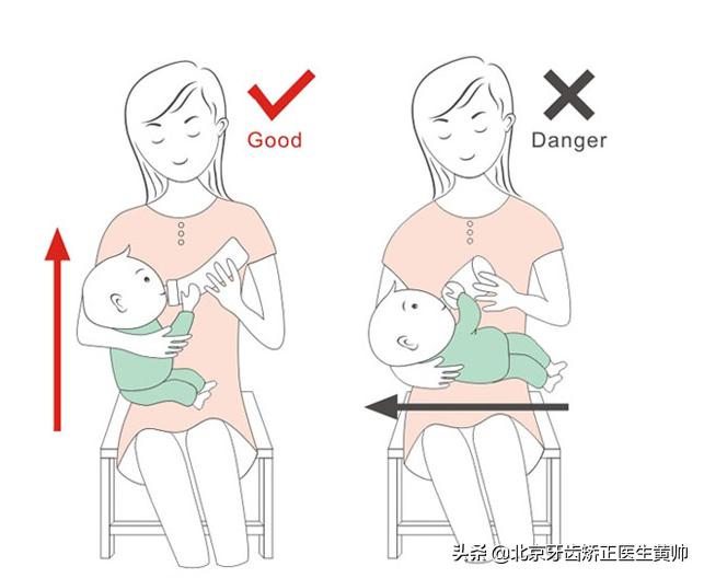 腺样体肥大牙齿矫正最佳年龄,儿童龅牙牙齿矫正最佳年龄