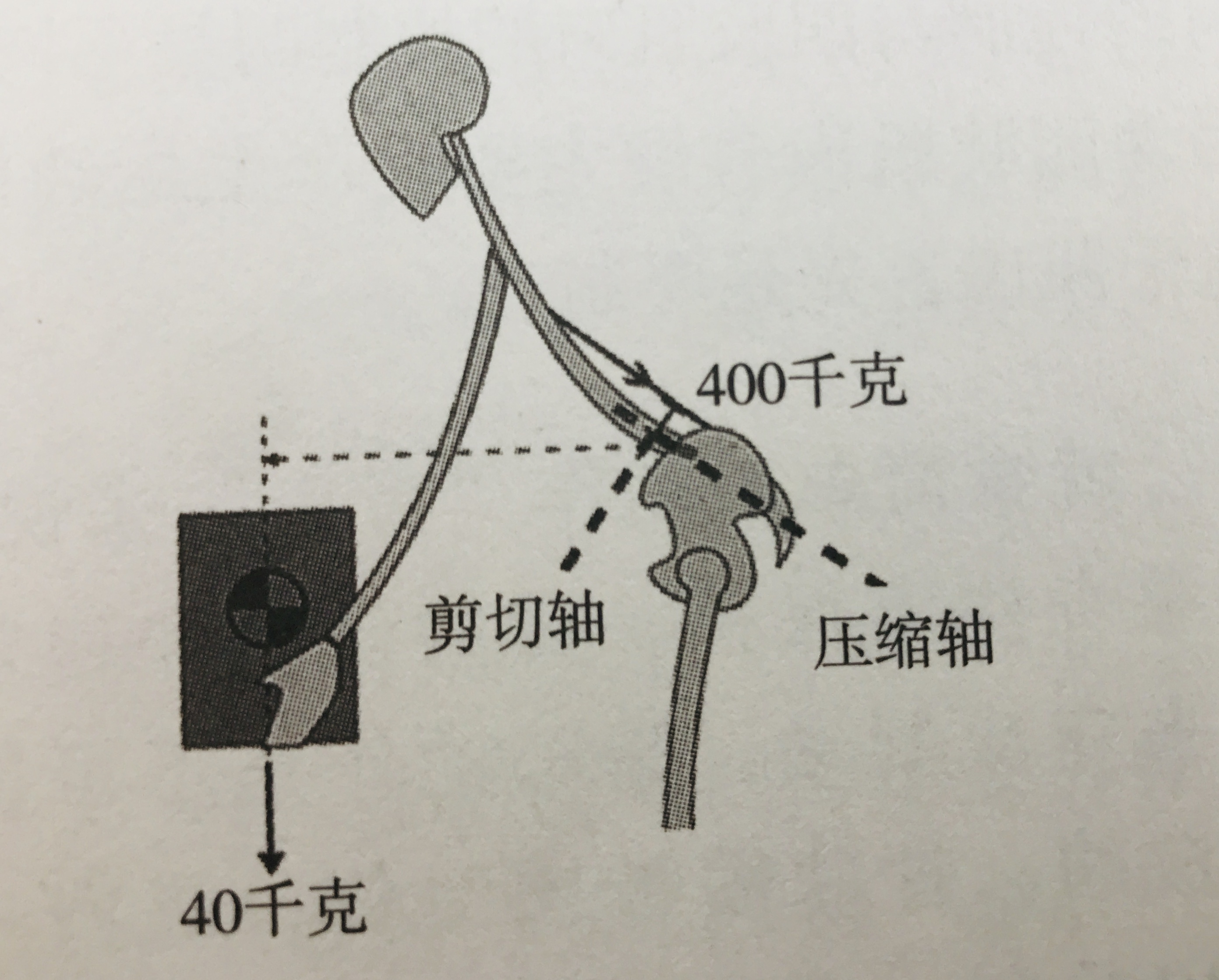 椎间盘的恢复,椎间盘恢复生理曲度方法