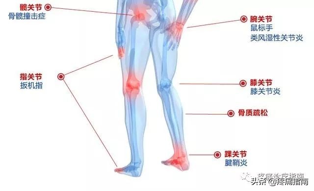 骨性关节炎诊疗指南,骨性关节炎诊疗指南欧美