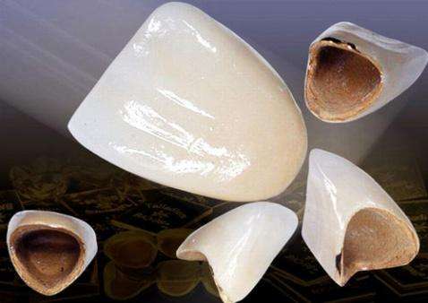 牙齿龋坏究竟要怎么办，补牙之后又能用多久呢？听听看牙医怎么说