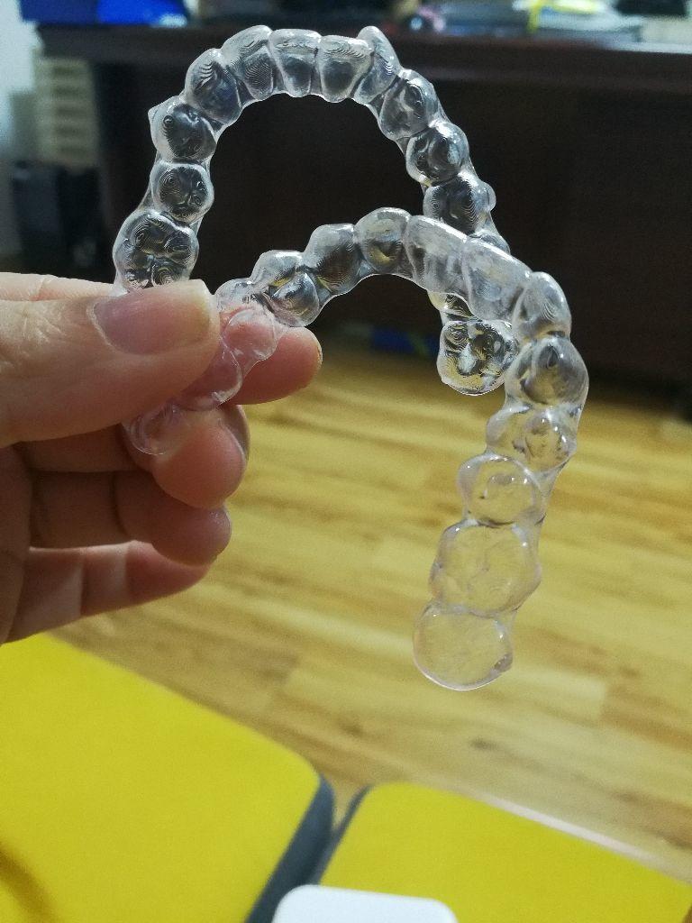 时代天使隐形牙套价格,时代天使隐形牙套能不能戴着吃饭