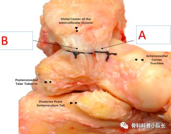 打篮球崴脚怎么处理热敷还是冷敷,崴脚超过48小时是热敷还是冷敷