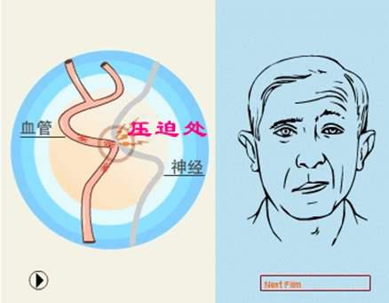 男人是左眼跳财右眼跳灾吗,所谓的左眼跳财右眼跳灾是真的吗