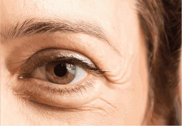 这些年我们踩过的护肤坑,目前最靠谱的去眼袋方法