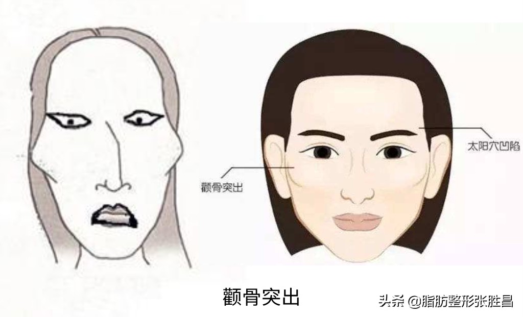 颧骨突出脸型长不好看,脸比较凶如何修饰
