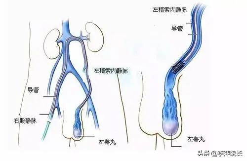 女人十三年不孕要做什么检查,女子三年不孕做检查