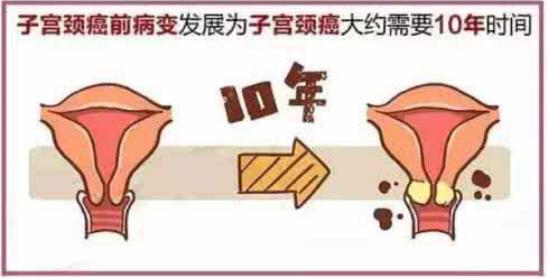 宫颈癌是不是最怕黄豆,宫颈癌是保不住子宫了吗