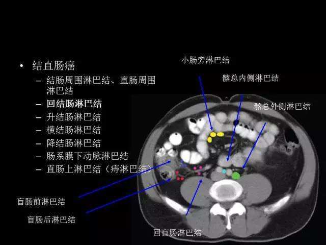 癌症辟谣,肿瘤患者辟谣