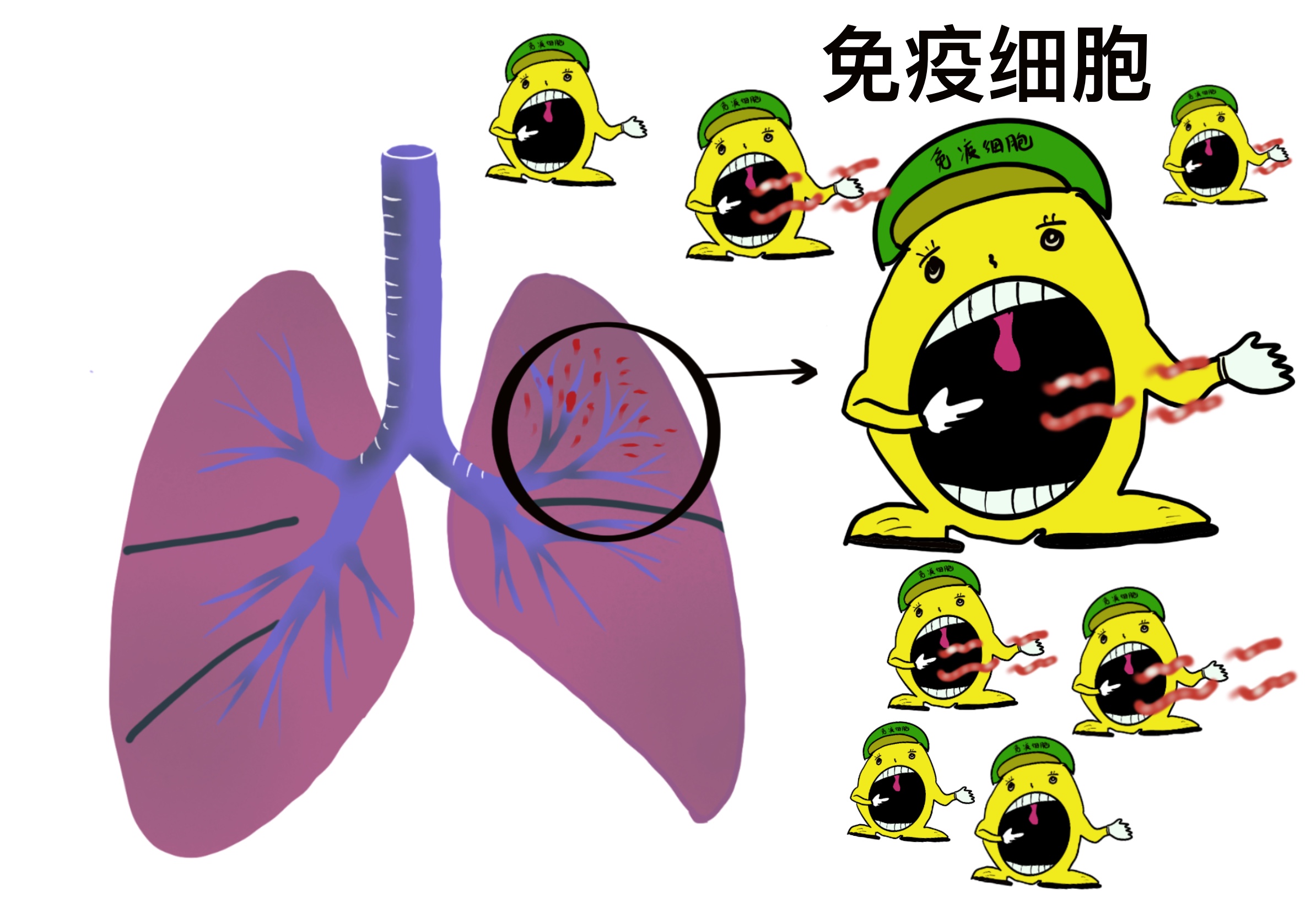 世界防治结核病日历史,世界结核病日来历