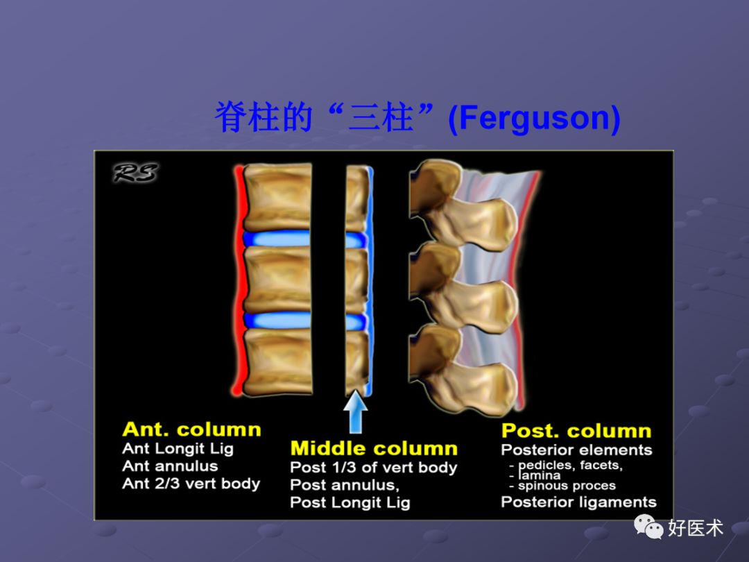 脊柱mri有哪些特点,乳腺疾病的mri诊断及鉴别