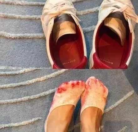 万元包包褪色，LV称中国水土问题！原来奢侈品都是一次*用品性**？