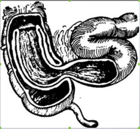 雨女无瓜的佛系带娃：孩子频繁呕吐要警惕！出现这一情况或要手术