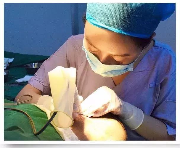 自体毛囊植发怎么植,自体毛发植发价格