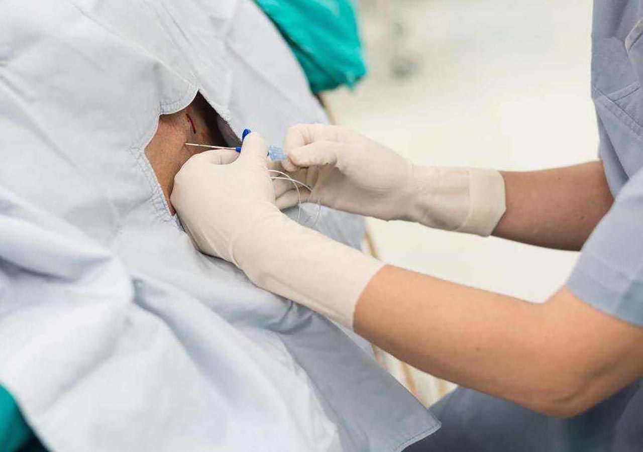 顺产or剖宫产到底应该怎样选择,顺产跟剖腹产对宝宝优点缺点对比