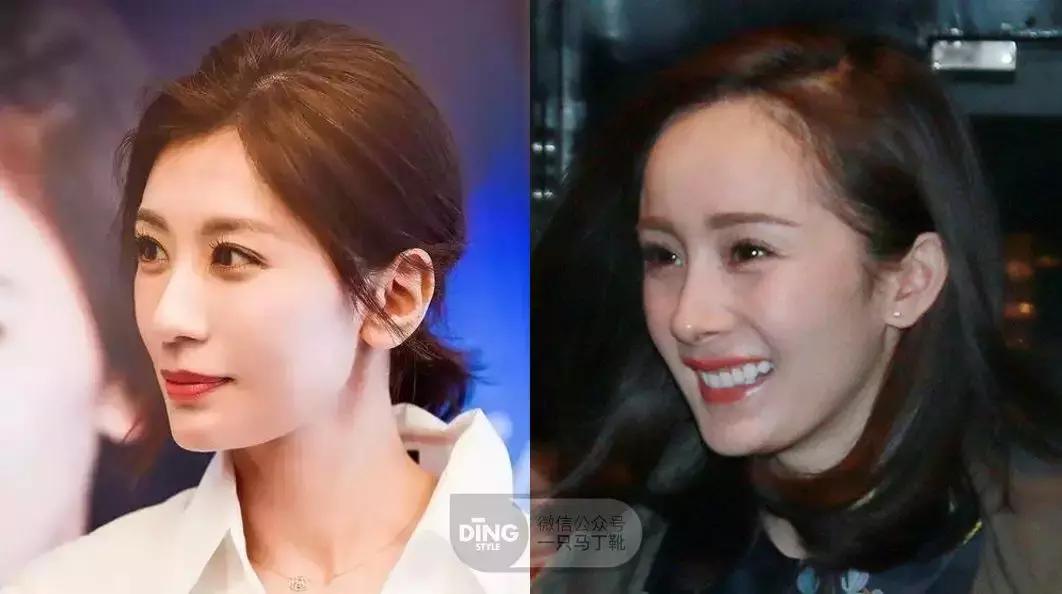 整牙一年半牙缝大,整牙一年了牙间距很大