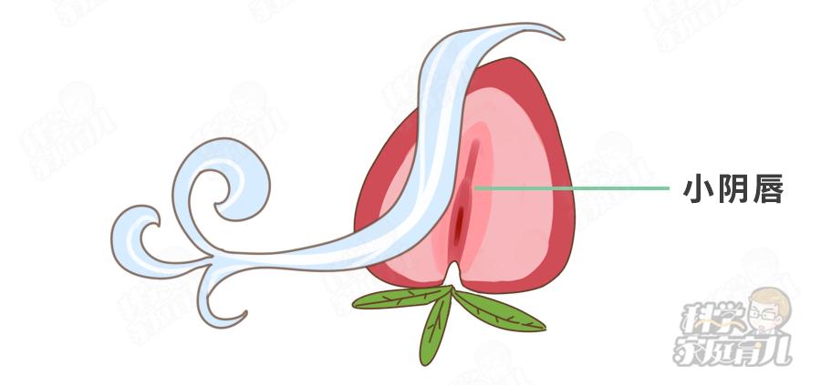 错不起！娃阴唇粘连，一碰就哭，到了这种程度，必须处理